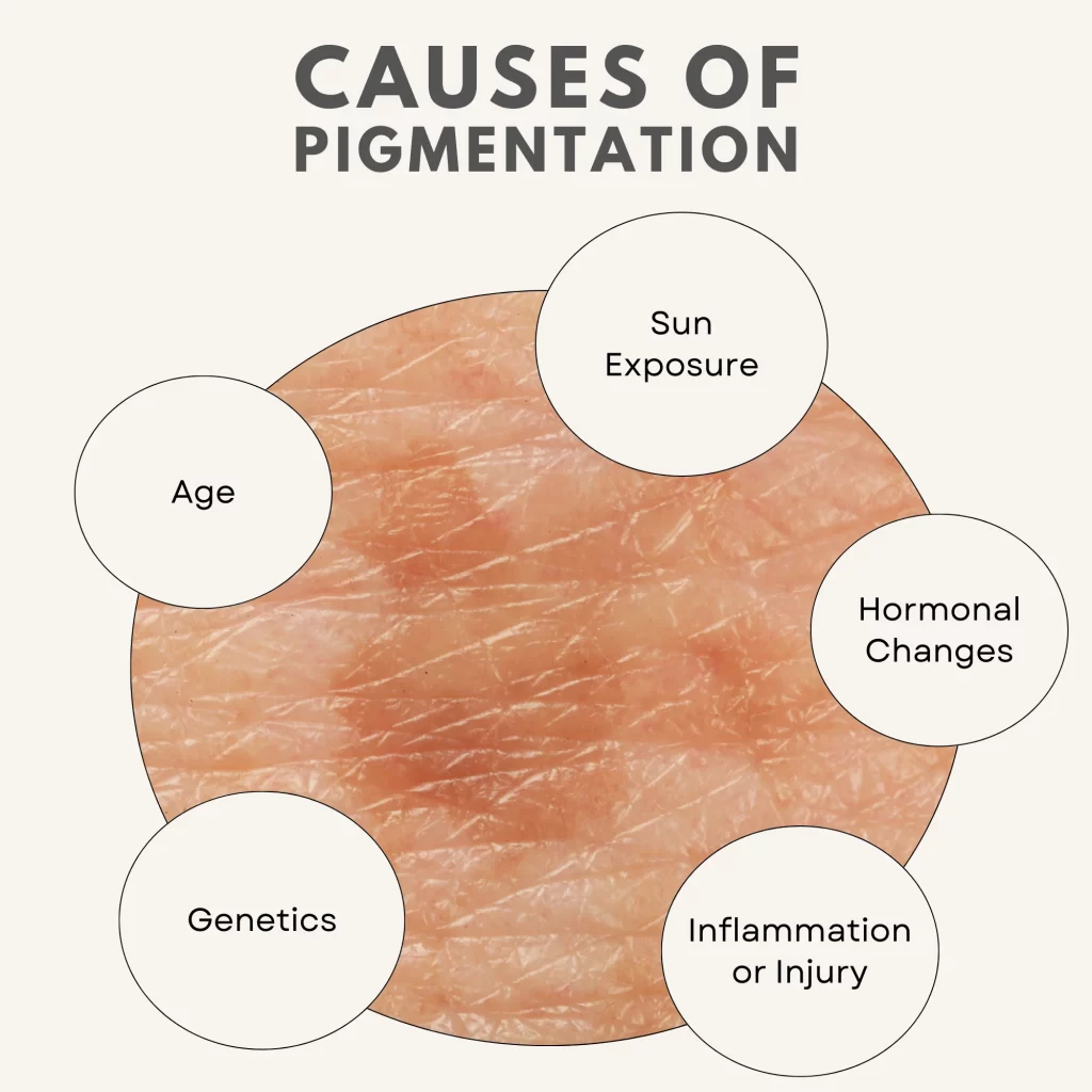 Causes Of Pigmentation