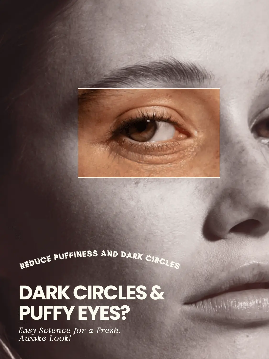 Reduce puffiness and dark circles