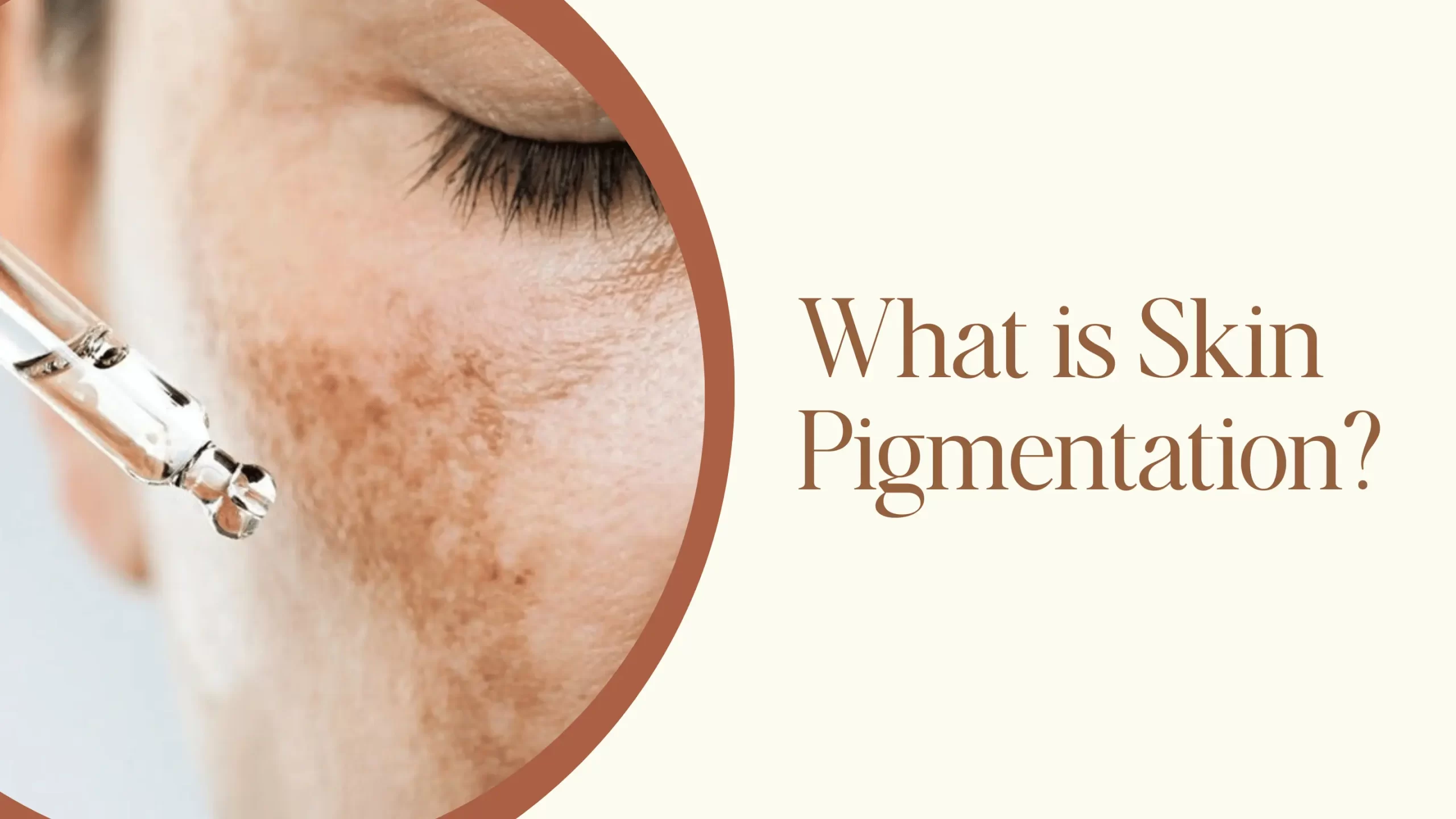 What is Skin Pigmentation?