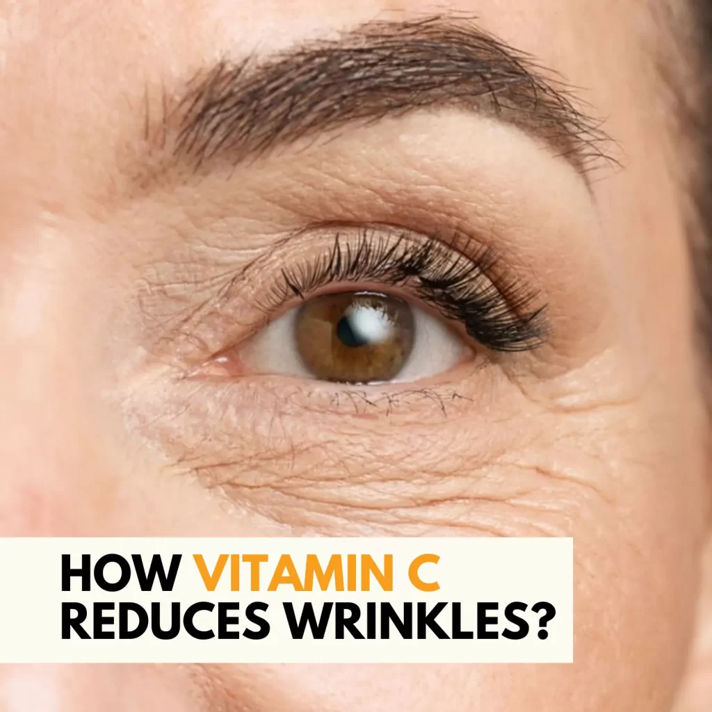 How Vitamin C Reduces Wrinkles?