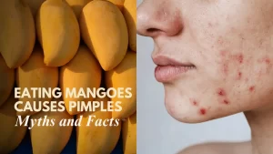 Does Eating Mangoes Cause Pimples